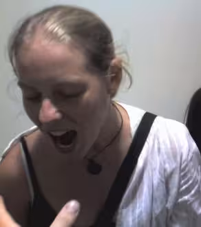 Cass biting Ryan Hellyer