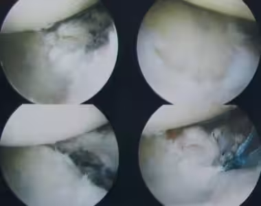 Internal shoulder photos