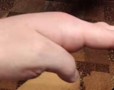 ma hand