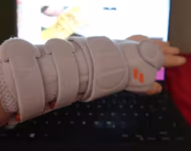 The cast is off :D :D :D
