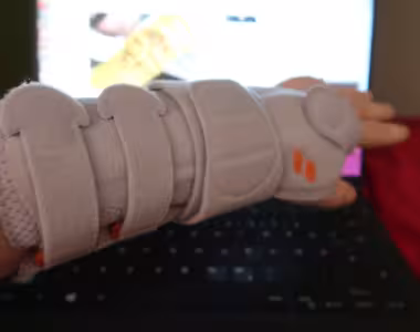 The cast is off :D :D :D