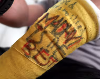 Arm art